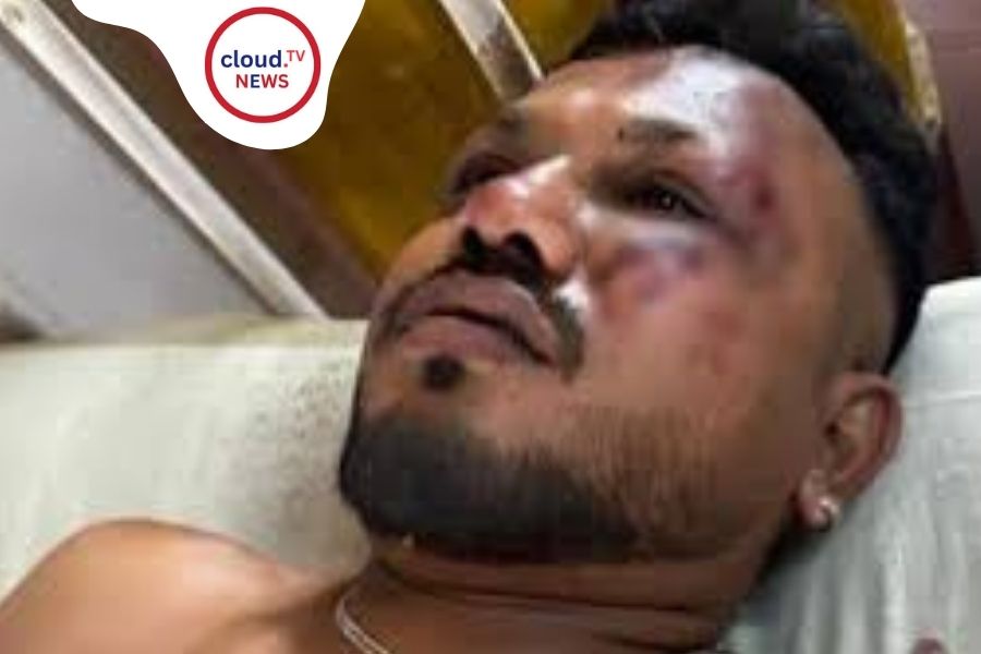 Biswas Kumar Ramesh Survives Horrific Explosion %%page%% %%sep%% %%sitename%%